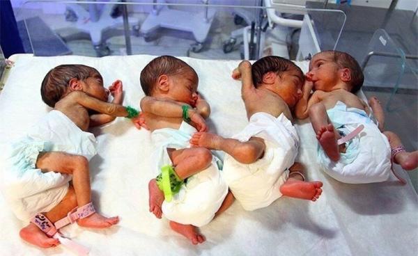 تولد بیش از 6 هزار چندقلو در کشور طی 4 ماه ، این 4 استان رکورددار چندقلوزایی در ایران هستند